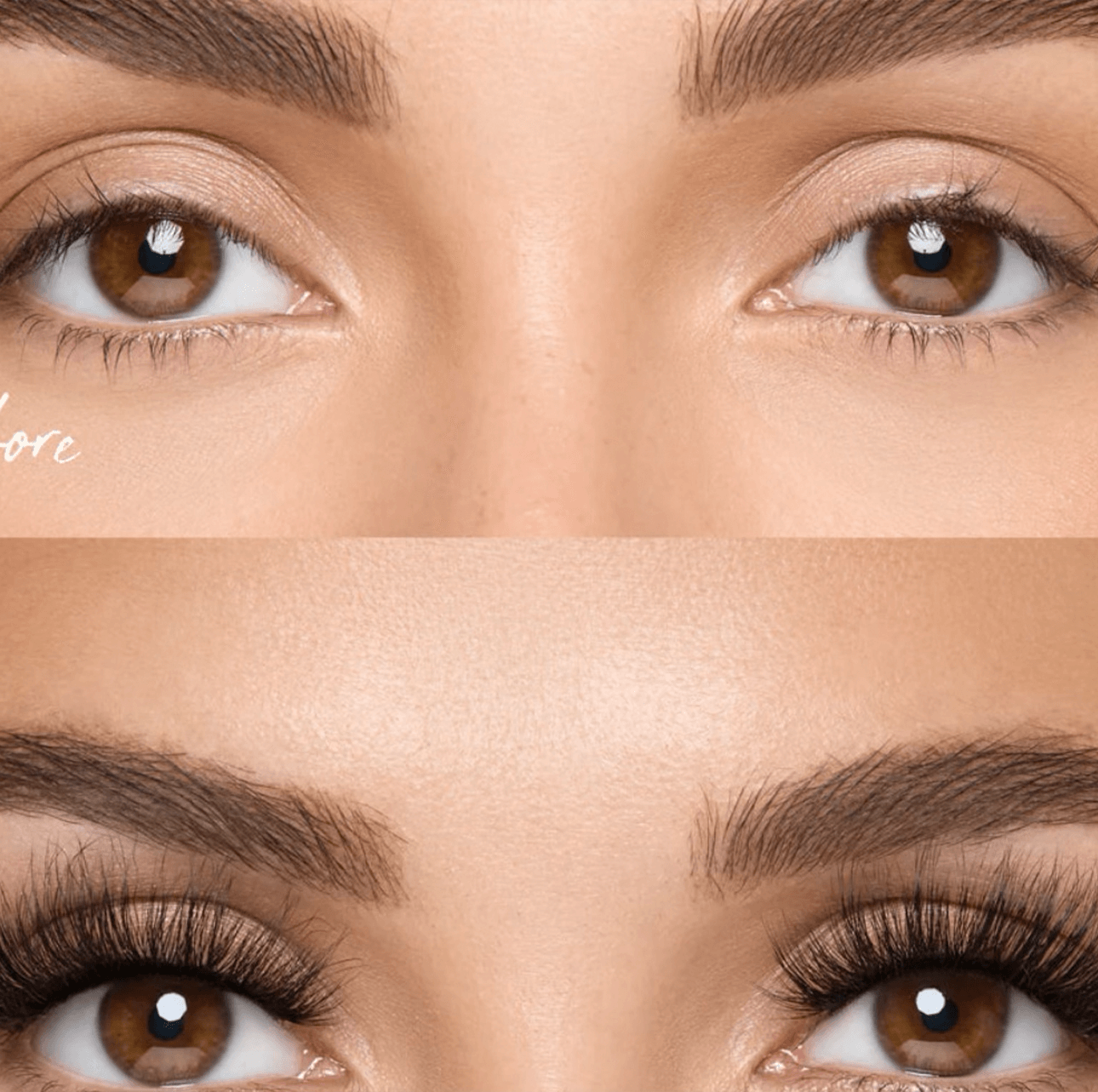 Lip Treatment